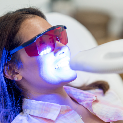 blanqueamiento dental led